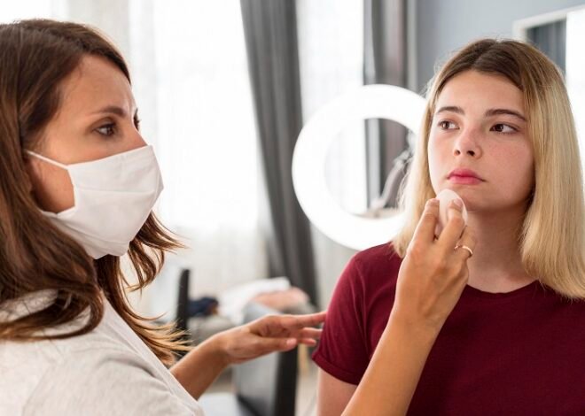 How can I minimize herpes outbreaks?